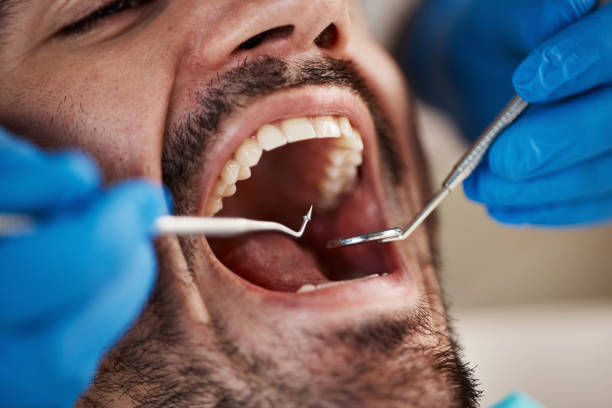 Best Urgent Dental Care  in Almont, MI